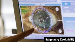 Számítógéppel vezérelt, femtolézeres szürkehályog-műtét a Semmelweis Egyetem Szemészeti Klinikáján 2014. október 29-én (képünk illusztráció)
