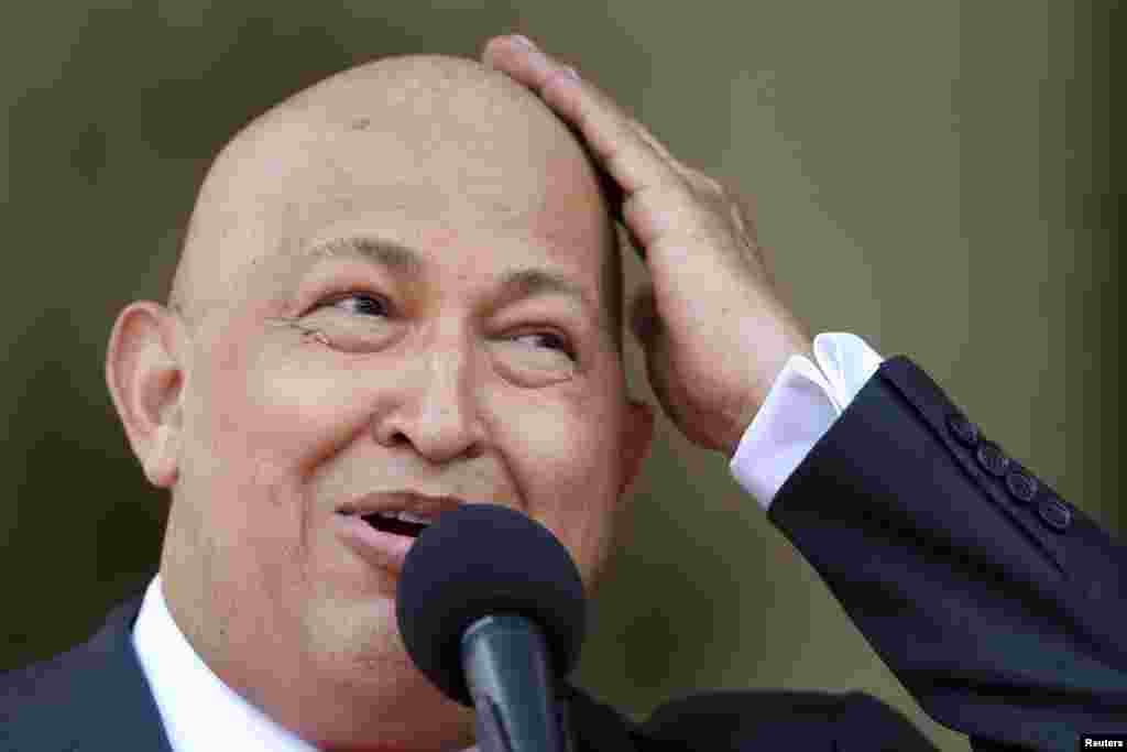 Chavez jokes about his baldness due to cancer treatment while talking to the media at Miraflores Palace in Caracas in August 2011.