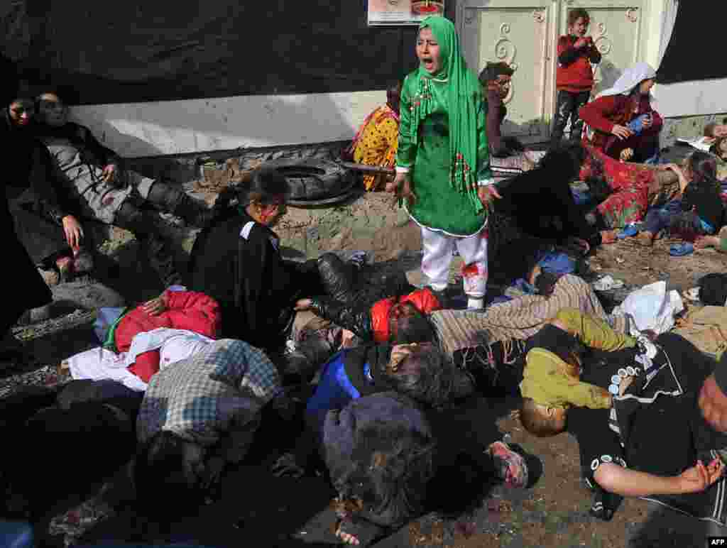 Fotografi që fitoi Çmimin Pulitzer. Në fotografi shihet Tarana Akbari, e mbijetuar pas një shpërthimi në Kabul.