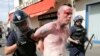 An injured man is led away by French police in Marseille following clashes between Russia and England supporters after a 1-1 draw in Marseille on June 11.