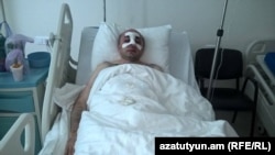 Armenia - Hayk Khanumian, an opposition parliamentarian, recovers in a hospital in Stepanakert after being attacked by unknown men, June 6, 2016