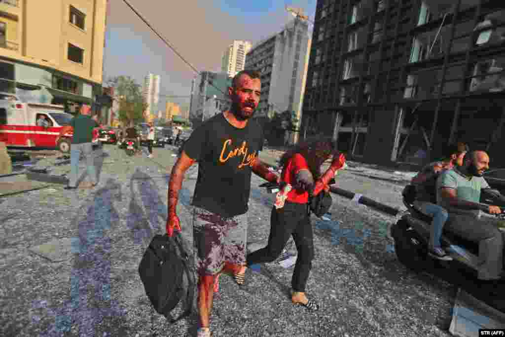 Njerëz të plagosur, duke u larguar nga zonat që u goditën nga shpërthimi masiv në Liban. 